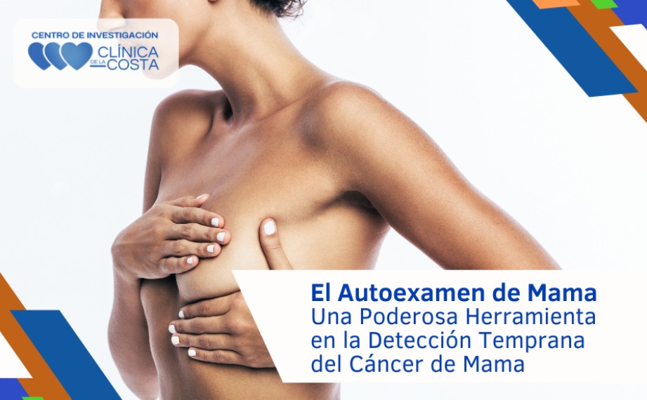 El Autoexamen de Mama: Una Poderosa Herramienta en la Detección Temprana del Cáncer de Mama